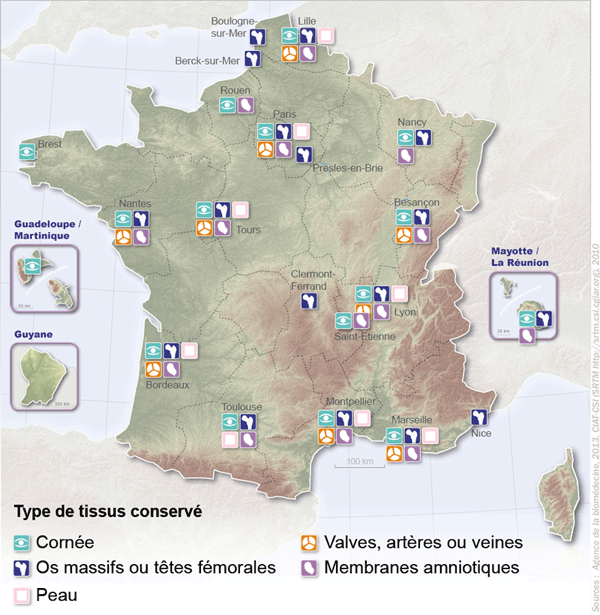 Figure T1. Répartition des banques de tissus selon le type de tissu conservé en 2012