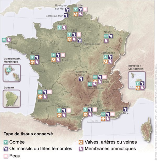 Figure T1. Répartition des banques de tissus selon le type de tissu conservé en 2013